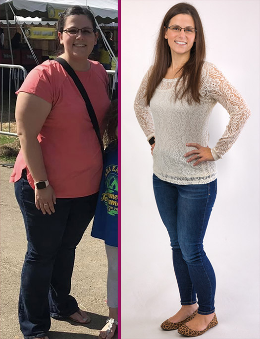 Amie Before and After the Gastric Sleeve Procedure