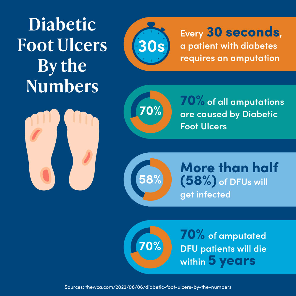 Diabetic Foot Ulcer Statistics